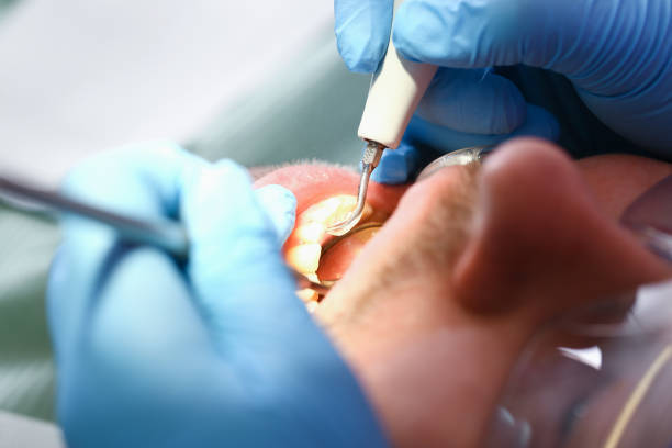 Best Emergency Root Canal Treatment in Farm Loop, AK