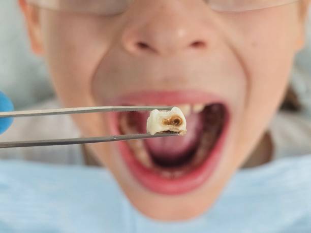 Best Emergency Dental Care for Broken or Chipped Teeth in Farm Loop, AK